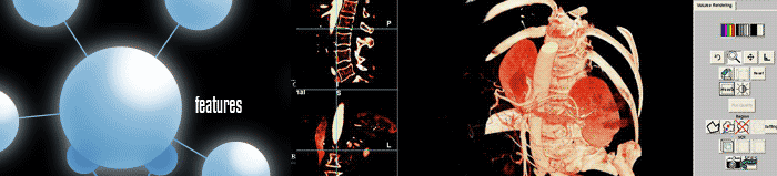 KB-Vold 3D - features